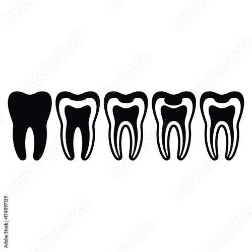 Cross section of teeth showing enamel dentin and pulp layers