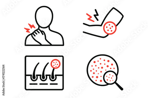 Pain and dermatology icon set. Vector symbols for joint pain, muscle ache, skin rash, and allergy. Medical illustration for eczema, psoriasis, and folliculitis treatment.