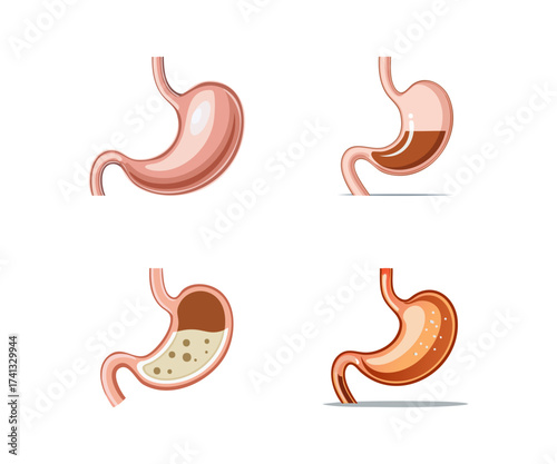 Stomach Conditions Anatomy Illustrations