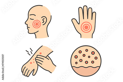 Dermatology icon set for skin disease and pain. Vector illustration of allergy, rash, itching, and inflammation. Medical symptom concepts like face ache, hand pain, and eczema.