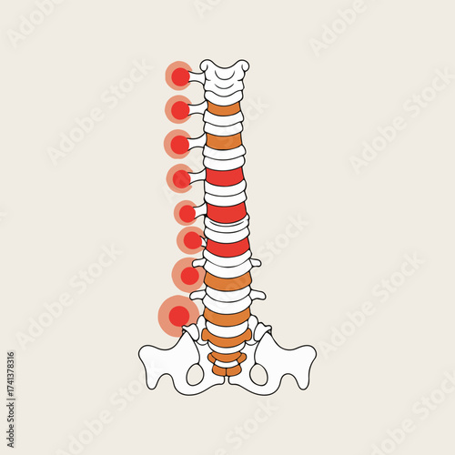 World Arthritis Day Vector Illustration Featuring Flat Minimalist Design, Joint Health, Pain Indicators, Awareness Ribbon, Exercise and Elderly Support, Perfect for Awareness Campaigns