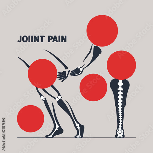 Flat Solid Color Vector for World Arthritis Day Showing Joint Pain, Mobility Exercises, Awareness Ribbon, Medical Infographic Style, Promoting Arthritis Care and Health Education