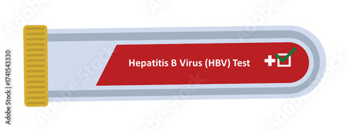 Illustration of a Hepatitis B Virus (HBV) blood test tube with a positive result symbol. Medical diagnostic concept for healthcare, laboratory testing, viral infection awareness, and prevention.