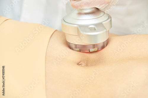 Female receiving radiofrequency body treatment on abdomen for skin tightening and cellulite reduction.