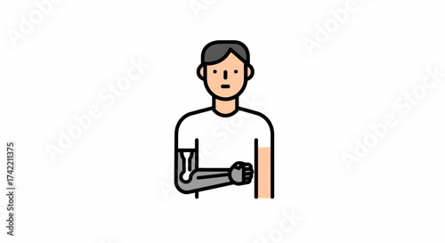 Modern Prosthetic Arm Technology Illustration for Human Augmentation.