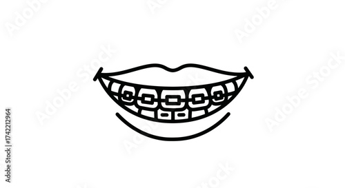 Smiling mouth with dental braces line art illustration for orthodontic care.