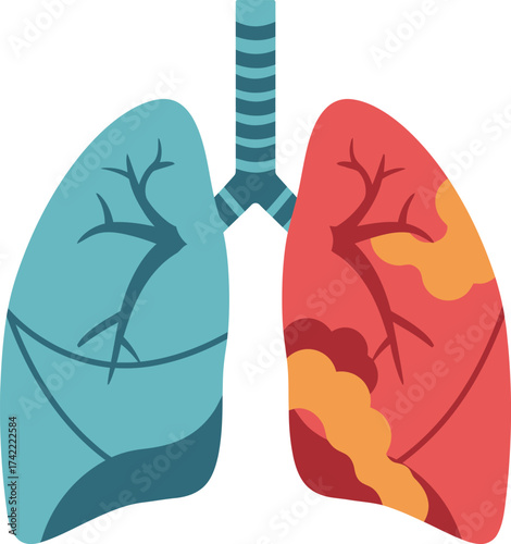 Healthy blue lung and diseased red lung anatomy medical illustration representing respiratory health isolated on transparent background