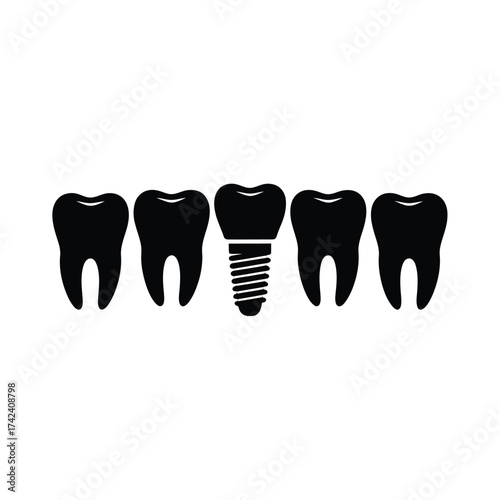 Dental implant among healthy teeth illustration