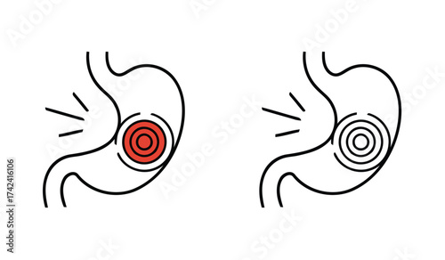 Stomach pain illustration with inflamed area and waves of pain depiction human anatomy