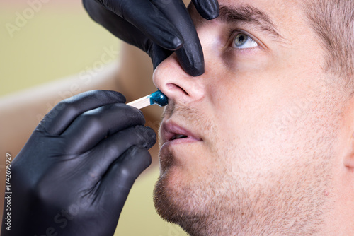 Man Getting Nose Hair Waxing Treatment at a Salon. Close-up of Blue Wax on Stick