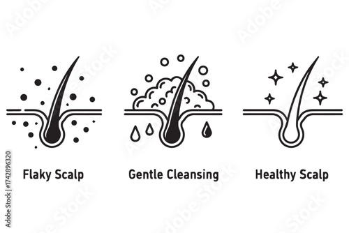 Illustrations showing hair follicle stages flaky scalp, gentle cleansing, and healthy scalp conditions isolated on transparent background