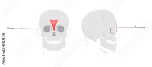 Procerus - Nasal muscle shown in anatomy diagram, responsible for drawing the skin between the eyebrows downward, expressing frowning medical reference and educational illustration