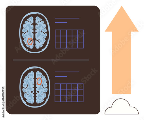 Brain scans with marked regions, data analysis grids, upward arrow, and cloud. Ideal for neuroscience, growth, progress, innovation data analytics healing learning. Simple flat metaphor