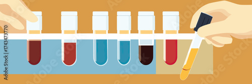 Laboratory test tubes with various blood and urine samples in rack and hands holding sample containers for medical analysis flat vector illustration