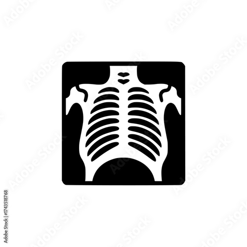 Vector art of xray of human rib cage