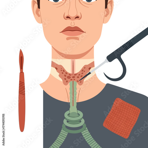 Thyroid surgery illustration for medical education or healthcare marketing, demonstrating surgical procedure with focus on precision and anatomical detail