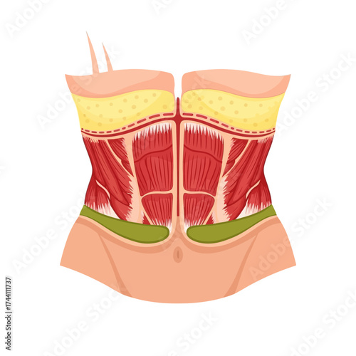 Torso showcasing abdominal muscles anatomy for medical education, textbook illustration displaying core muscles and fat tissue in realistic detail