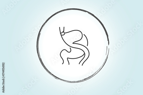 Band on bypass” likely refers to a combination bariatric procedure where a gastric band is placed on a patient who has previously undergone a gastric bypass, usually to further control food intake or 