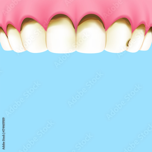 Upper teeth (Decay) - Text box banner (square) illustration vector design. Dental care concept.