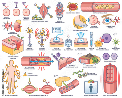Diabetes Mellitus is illustrated with insulin resistance, blood glucose test, and damaged beta cells, transparent background. Outline style worksheet collection