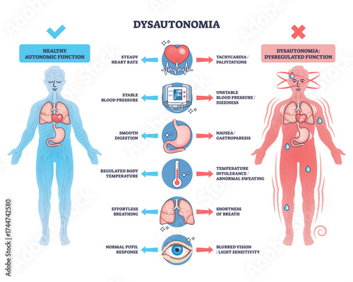 Dysautonomia overview showing differences in autonomic function with human figures, organs, and symptom icons, transparent background.