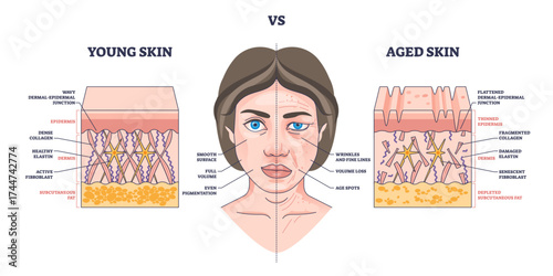 Young vs aged skin shows differences in collagen, elasticity, and wrinkles with labeled skin layers, transparent background.