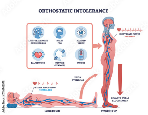 Orthostatic intolerance is shown with a person standing, blood flow changes, and symptom icons to illustrate effects of posture change, transparent background.