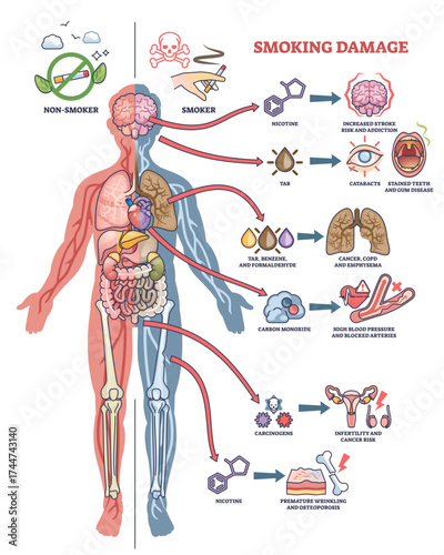 Smoking damage diagram shows human body outline, highlighting organs, arrows, and harmful effects of smoking, transparent background.
