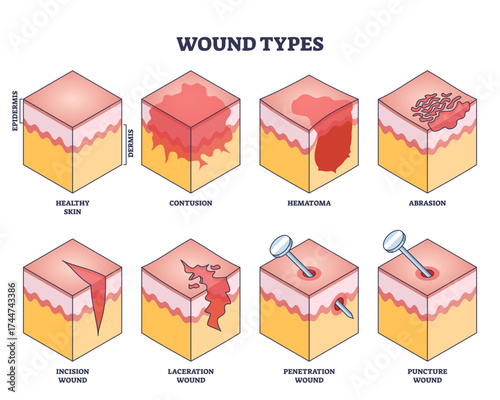 Wound types diagram shows different skin injuries including contusion, abrasion, and laceration with clear labeled sections, transparent background.