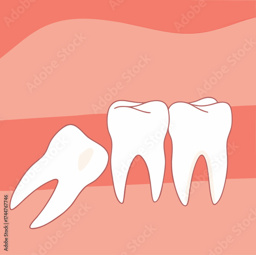 Wisdom tooth. Wisdoms teeth dental problem, gum pain, remove teeths dentist.oral health, toothache. Flat vector illustration

