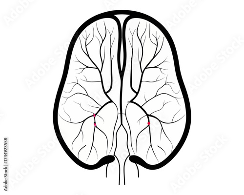 Illustration of a brain with arteries and veins depicted in black lines and two red dots on white background | editable eps vectors silhouette