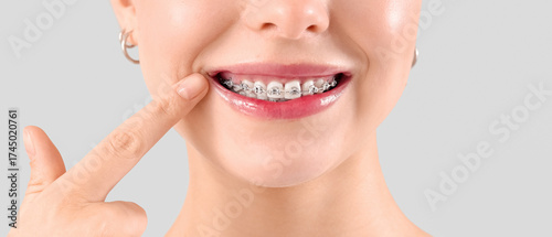Young woman with dental bra...