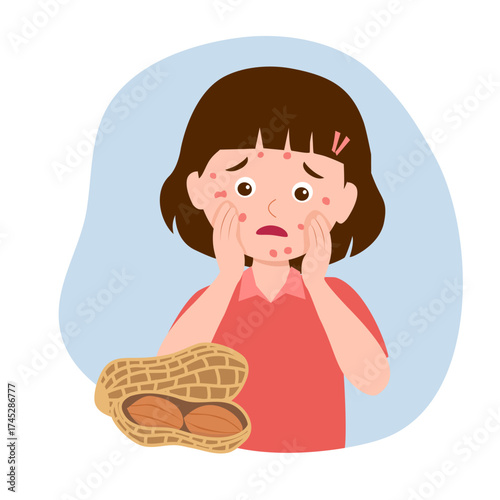 Kid with allergy from peanuts. Runny nose and watery eyes. Seasonal disease. Causes of allergy. Illness with cough, cold and sneeze symptoms. Vector illustration