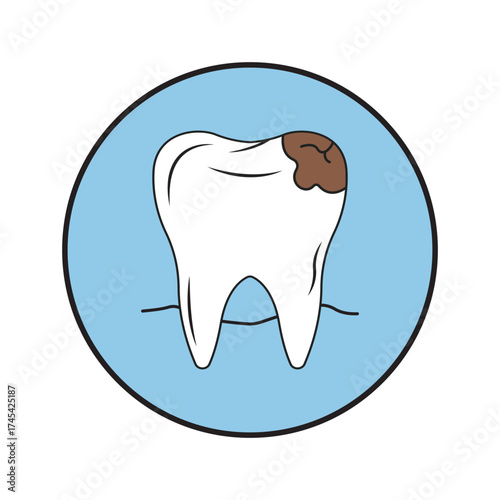 Dental Decay Illustration Tooth Cavity Infection Caries Dental Health Oral Hygiene Healthcare Dental Treatment White