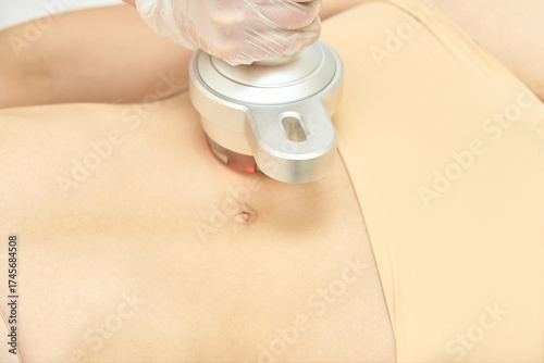 Close-up of ultrasonic cavitation on caucasian female abdomen for fat reduction and body contouring.
