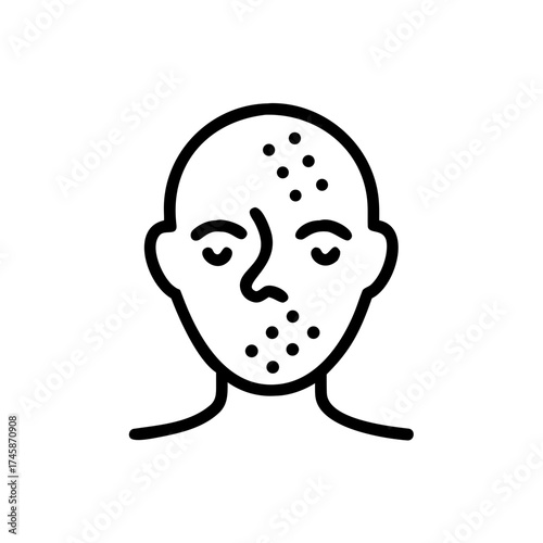 Graphic representation of allergic reaction with visible skin symptoms  