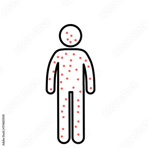 Stick figure illustration showing a person with chickenpox