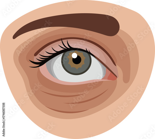 Dark Circle Under Eye Illustration Isolated on White Background