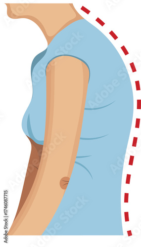 Woman Slouching Stand Posture Side View with Line Illustration Isolated on White Background
