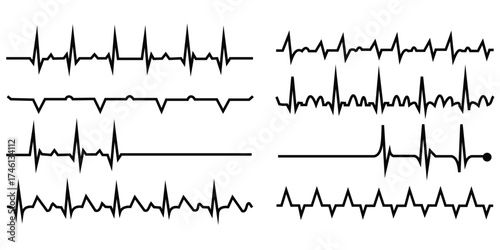 Dynamic Heartbeat Line Vector Set — Medical Pulse, Cardiogram, and Health Monitoring Icons
