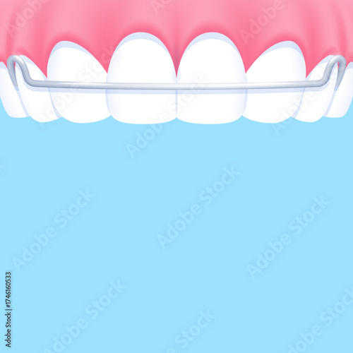 Upper teeth (Hawley retainer) - Text box banner (square) illustration vector design. Dental care concept.
