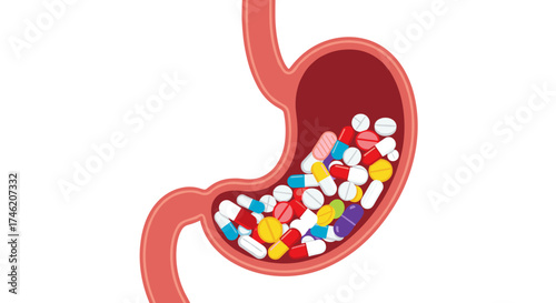 A graphic representation of a stomach filled with numerous colorful pills and capsules.