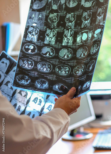 Doctor holding and examining MRI or CT scan images with human organs in light. Concept of medical diagnostics, radiology, examination and health research.