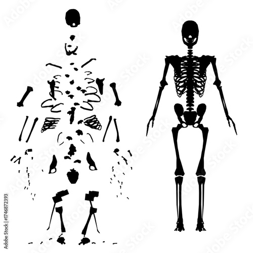 An exploded skeleton diagram in animated silhouette style displays individual bones separated for anatomical study. The black and white illustration on a clean white background clearly shows.