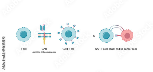 CAR T-cell therapy, killing of tumor cells. Cancer therapy. Chimeric antigen receptor T cell ,CAR T cell, for use in immunotherapy. Genetic engineering. Chemotherapy. Vector illustration.