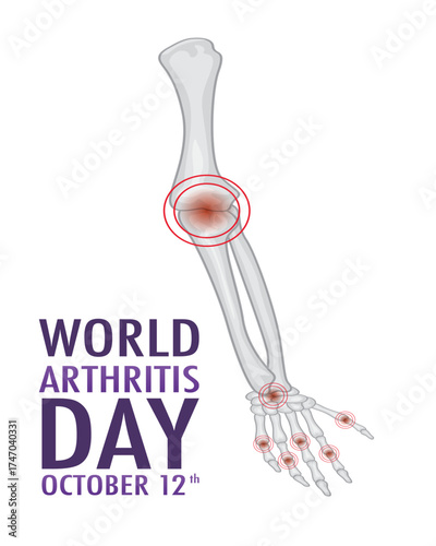 Vector graphic of world arthritis day good for world arthritis day celebration.