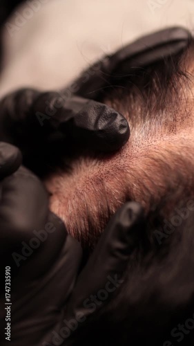 Process of scalp micropigmentation (SMP) for restoring the look of a fuller head of hair and defining a natural hairline