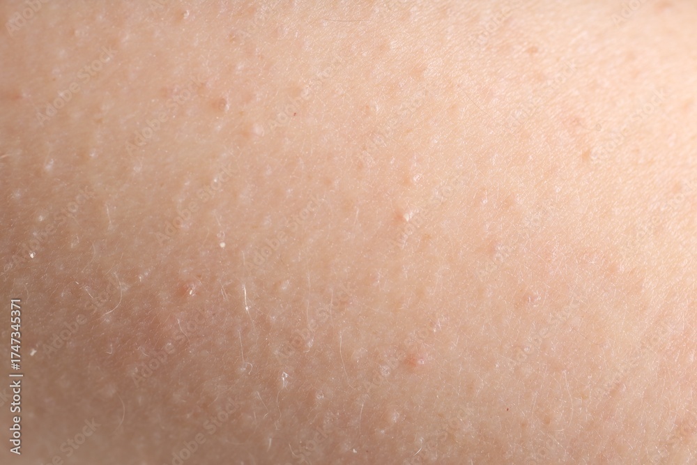 Fototapeta premium Texture of normal skin as background, closeup