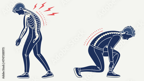 Illustration of back pain and spinal problems in a person showing different postures and pain intensity.