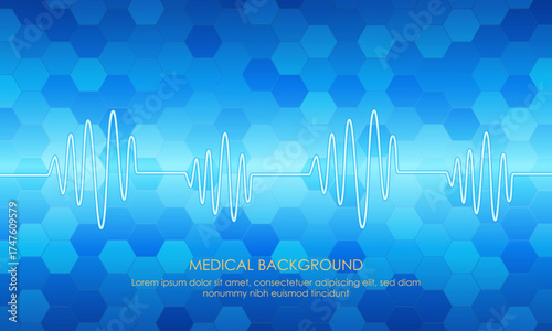 Illustration of Emergency ekg monitoring. Blue Glowing Neon Heart Pulse. Heartbeat. Light Blue Background with a Grid. Vector Illustration. All in a single layer.